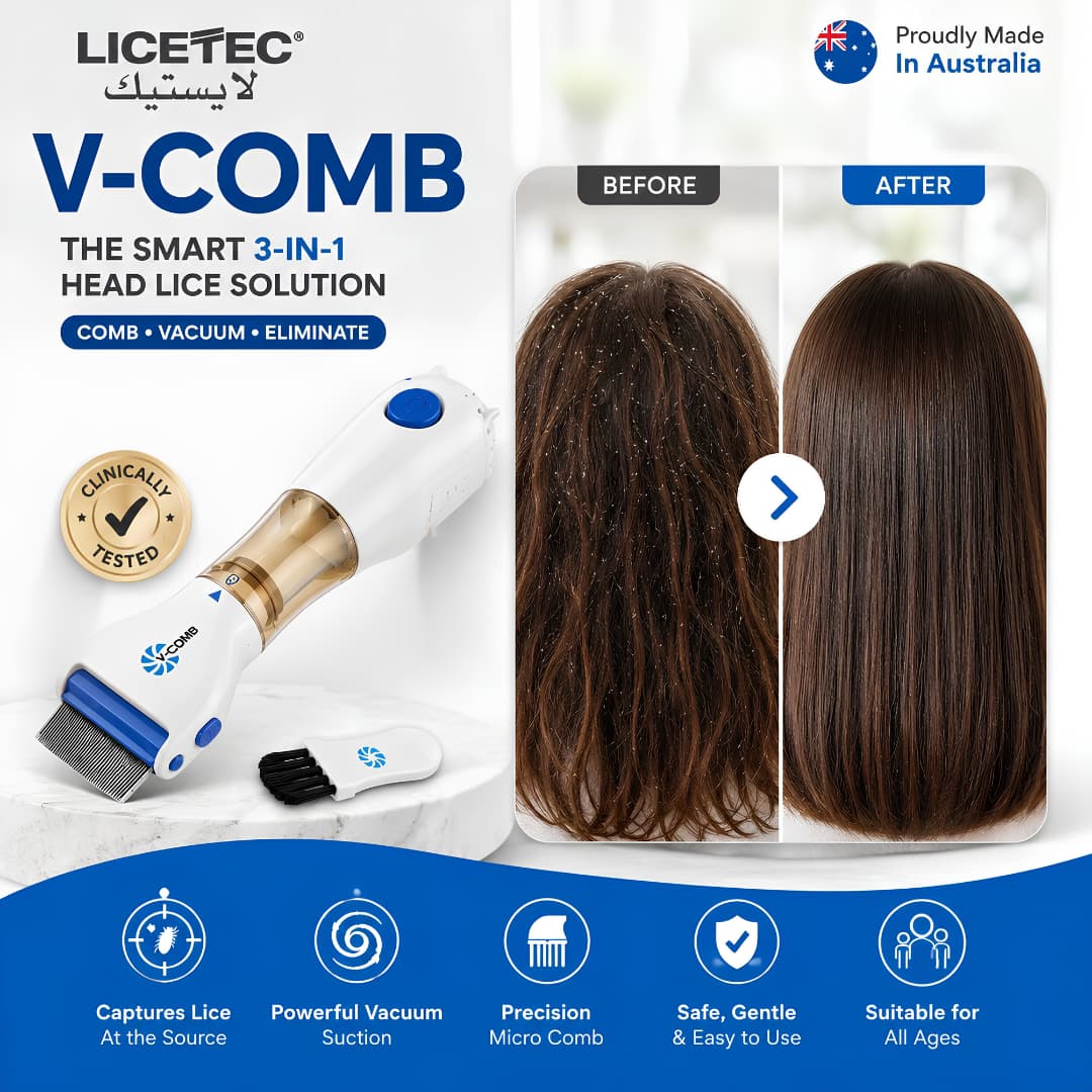 V-Comb Head Lice Removal Device – Safe & Chemical-Free Lice Solution
